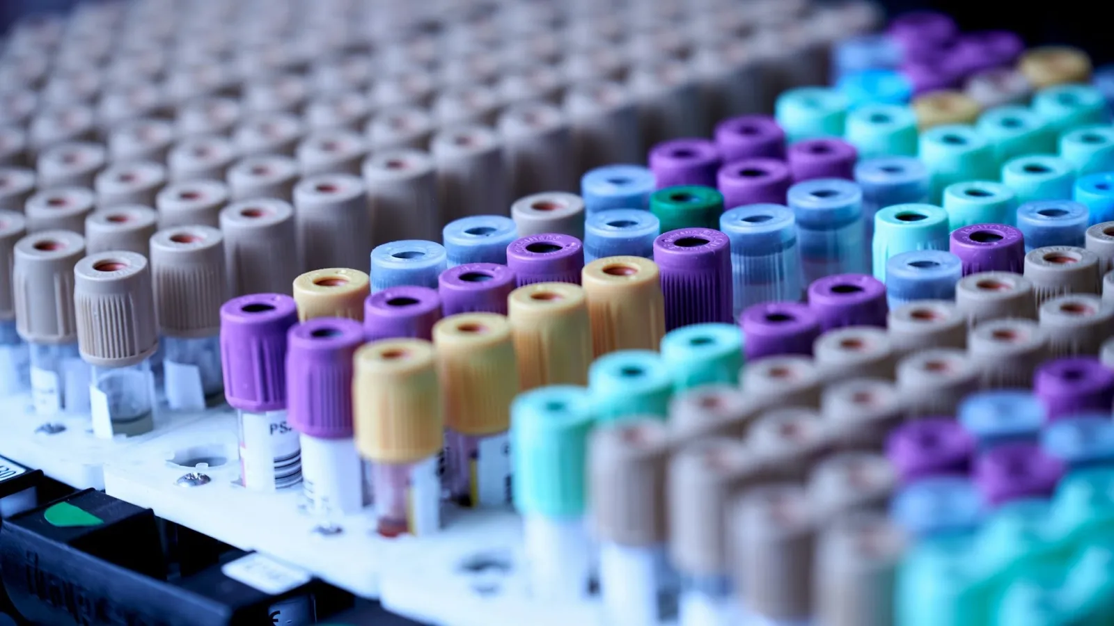 Labeled blood collection tubes racked in a diagnostic laboratory