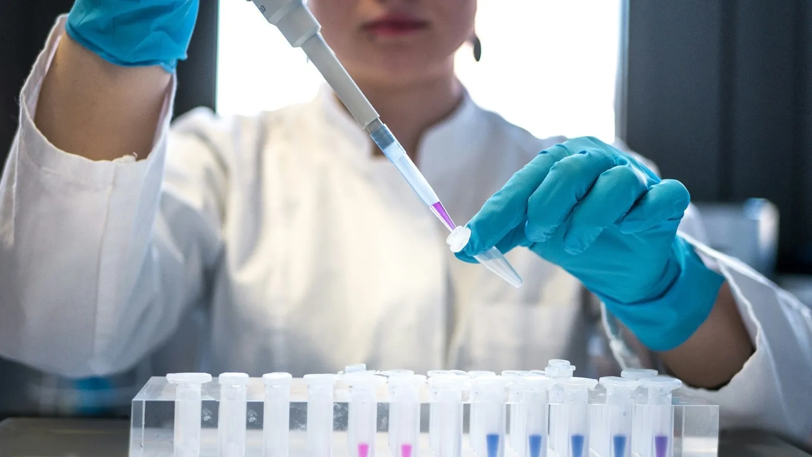 Laboratory technician pipetting samples for gut health testing